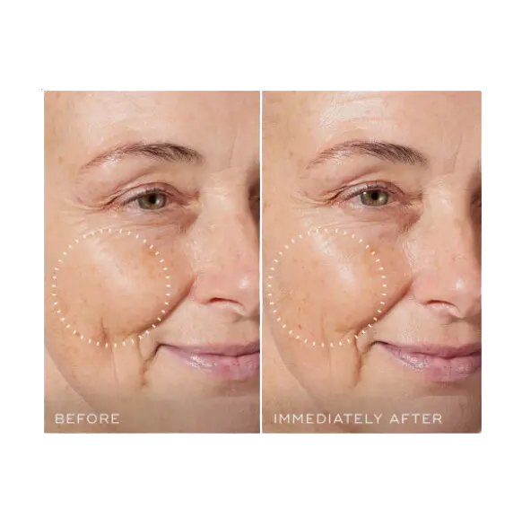 TOTAL MOISTURE DAILY FACIAL CREAM - ежедневный крем для глубокого увлажнения кожи мгновенного действия 50 мл TOTAL MOISTURE DAILY FACIAL CREAM - ежедневный крем для глубокого увлажнения кожи мгновенного действия2