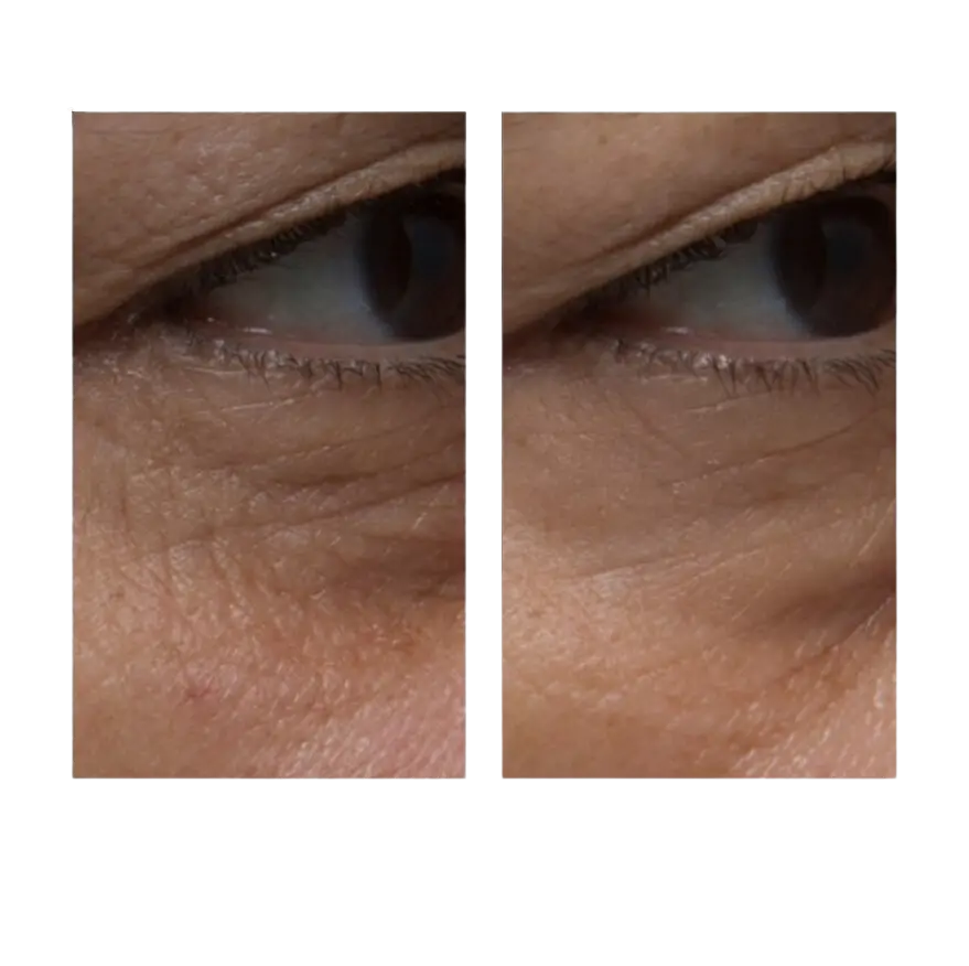 ELEMIS Pro-Collagen Definition Eye & Lip Contour Cream - Лифтинг-крем для век и губ, 15 мл**термін придатності 09.25р ELEMIS Pro-Collagen Definition Eye & Lip Contour Cream - Лифтинг-крем для век и губ, 15 мл1