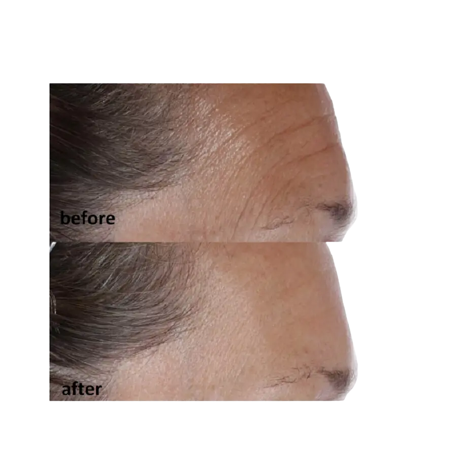 Essential Fx Acyl-Glutathione Chia Facial Oil - Питательная сыворотка с маслом чиа и ацил-глутатионом - 30 мл Essential Fx Acyl-Glutathione Chia Facial Oil - Питательная сыворотка с маслом чиа и ацил-глутатионом - 30 мл4